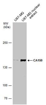 CA150 Antibody in Western Blot (WB)