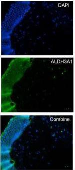 ALDH3A1 Antibody in Immunohistochemistry (Frozen) (IHC (F))