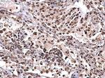 NPM1 Antibody in Immunohistochemistry (Paraffin) (IHC (P))