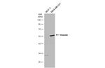 Vimentin Antibody in Western Blot (WB)