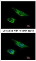 Vimentin Antibody in Immunocytochemistry (ICC/IF)