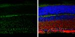 Vimentin Antibody in Immunohistochemistry (Paraffin) (IHC (P))