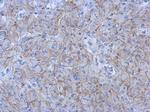 N-cadherin Antibody in Immunohistochemistry (Paraffin) (IHC (P))