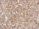 N-cadherin Antibody in Immunohistochemistry (Paraffin) (IHC (P))