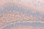 alpha Synuclein Antibody in Immunohistochemistry (Paraffin) (IHC (P))