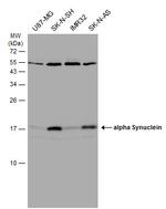 alpha Synuclein Antibody in Western Blot (WB)