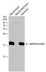 alpha Synuclein Antibody in Western Blot (WB)