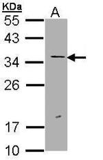 ERCC1 Antibody in Western Blot (WB)