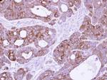 14-3-3 sigma Antibody in Immunohistochemistry (Paraffin) (IHC (P))