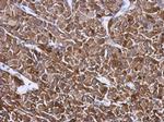 HSP27 Antibody in Immunohistochemistry (Paraffin) (IHC (P))