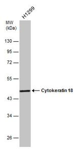 Cytokeratin 18 Antibody in Western Blot (WB)