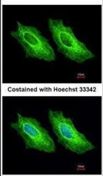 Cytokeratin 18 Antibody in Immunocytochemistry (ICC/IF)