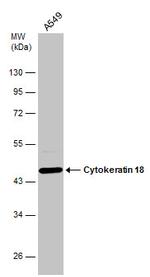 Cytokeratin 18 Antibody in Western Blot (WB)