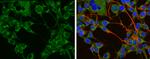 Tyrosine Hydroxylase Antibody in Immunocytochemistry (ICC/IF)