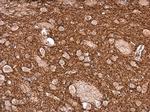 Tyrosine Hydroxylase Antibody in Immunohistochemistry (Paraffin) (IHC (P))