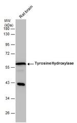 Tyrosine Hydroxylase Antibody in Western Blot (WB)