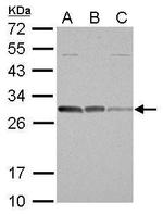 Bcl-10 Antibody in Western Blot (WB)