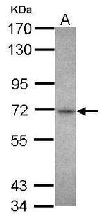 CHK2 Antibody in Western Blot (WB)