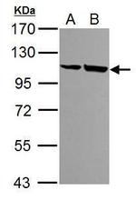 alpha Actinin 4 Antibody in Western Blot (WB)