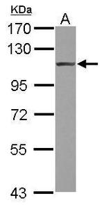 alpha Actinin 4 Antibody in Western Blot (WB)