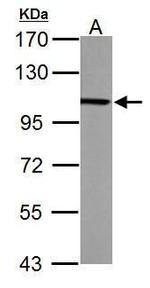 alpha Actinin 4 Antibody in Western Blot (WB)