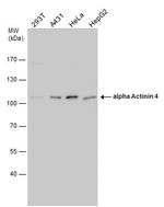 alpha Actinin 4 Antibody in Western Blot (WB)