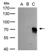 BMPR1A Antibody in Western Blot (WB)