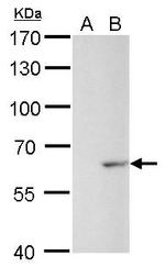 GAD67 Antibody in Western Blot (WB)