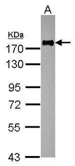 CD11a Antibody in Western Blot (WB)