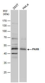 PAX6 Antibody in Western Blot (WB)