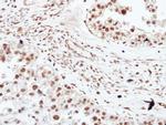 HDAC3 Antibody in Immunohistochemistry (Paraffin) (IHC (P))