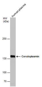 Ceruloplasmin Antibody in Western Blot (WB)