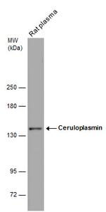 Ceruloplasmin Antibody in Western Blot (WB)