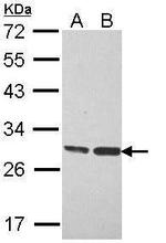 ERAB Antibody in Western Blot (WB)