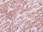 IDH3G Antibody in Immunohistochemistry (Paraffin) (IHC (P))