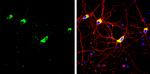 STIM1 Antibody in Immunocytochemistry (ICC/IF)