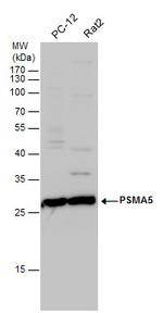 PSMA5 Antibody in Western Blot (WB)