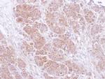 SNAP25 Antibody in Immunohistochemistry (Paraffin) (IHC (P))