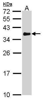 VDAC Antibody in Western Blot (WB)