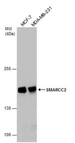 SMARCC2 Antibody in Western Blot (WB)