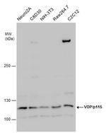 VDP Antibody in Western Blot (WB)