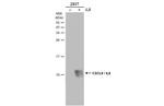 IL-8 (CXCL8) Antibody in Western Blot (WB)