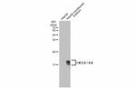 IL-8 (CXCL8) Antibody in Western Blot (WB)