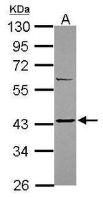 SSTR2 Antibody in Western Blot (WB)