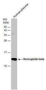 HBB Antibody in Western Blot (WB)