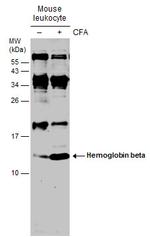 HBB Antibody in Western Blot (WB)