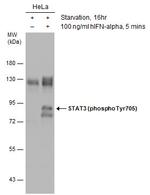 Phospho-STAT3 (Tyr705) Antibody in Western Blot (WB)