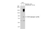 Phospho-STAT3 (Tyr705) Antibody in Western Blot (WB)