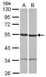 beta Tubulin Antibody in Western Blot (WB)