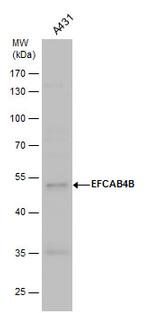 EFCAB4B Antibody in Western Blot (WB)